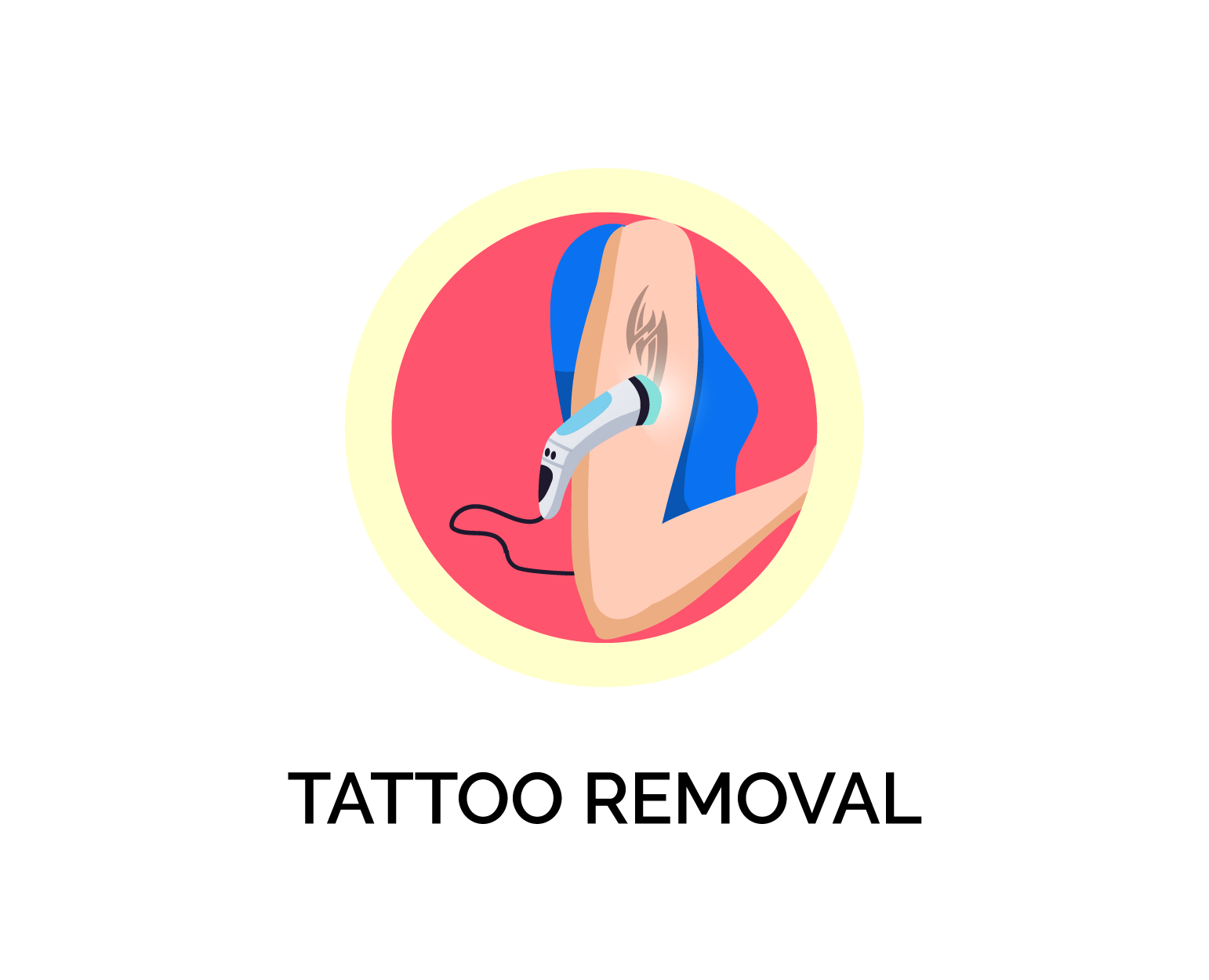 tattoo removal