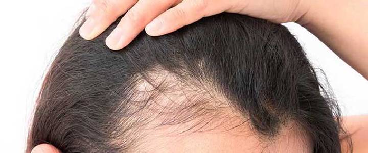 Hair Care treatment at Skinzest