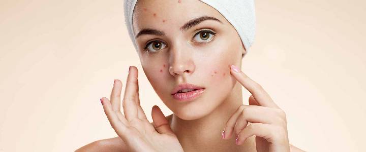 Acne treatment at Skinzest
