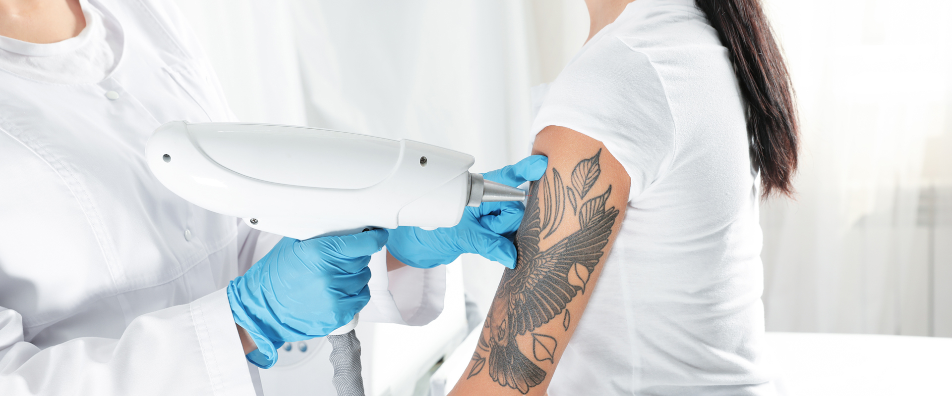 Tattoo Removal