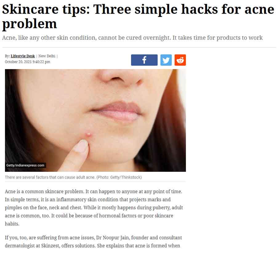 Skincare tips three simple hacks for acne problem — Indian Express