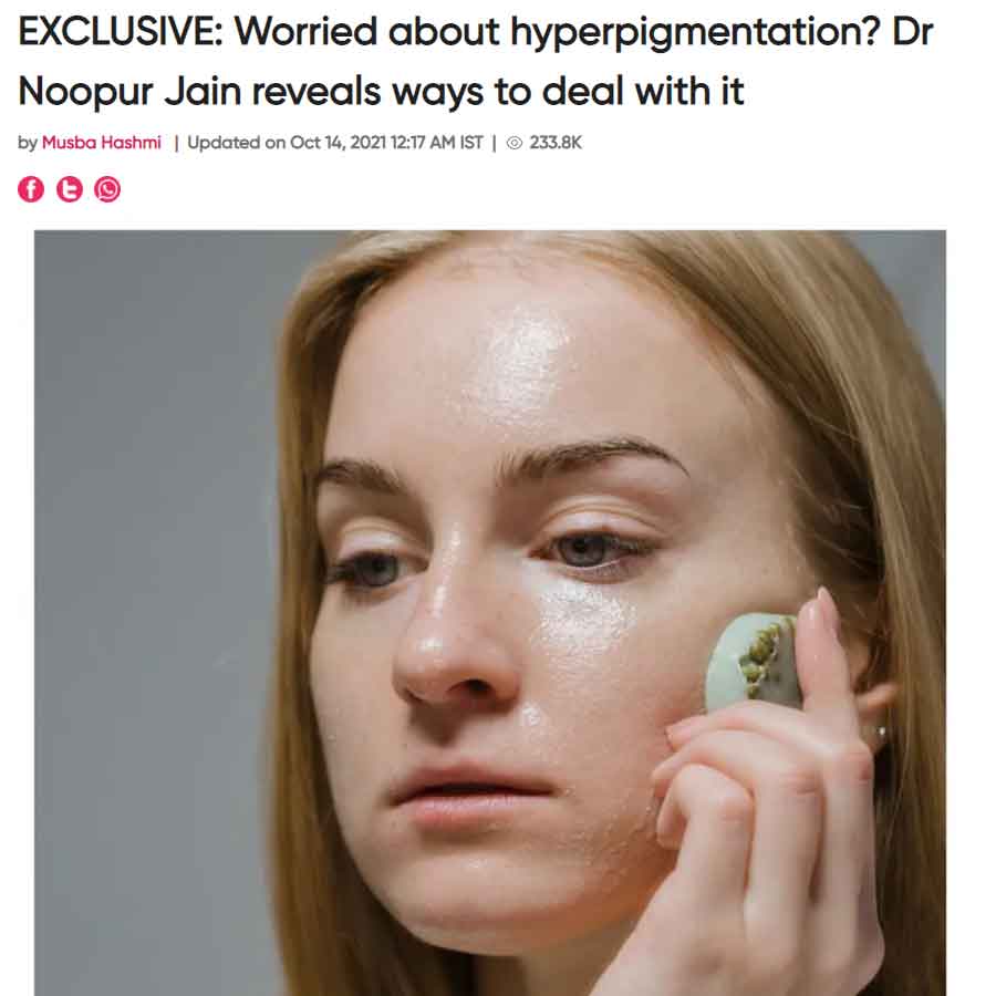 Exclusive worried about hyperpigmentation dr noopur jain reveals ways deal it — Pink Villa