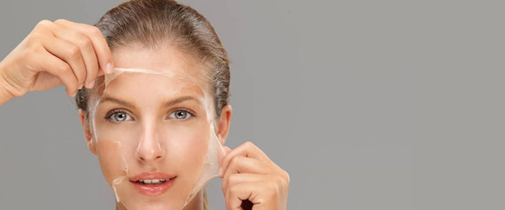Peeling treatment at Skinzest