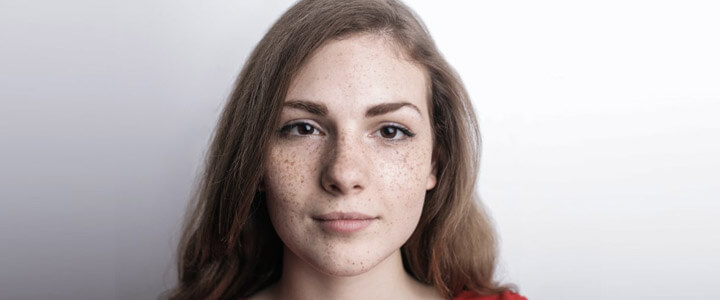 Pigmentation treatment at Skinzest
