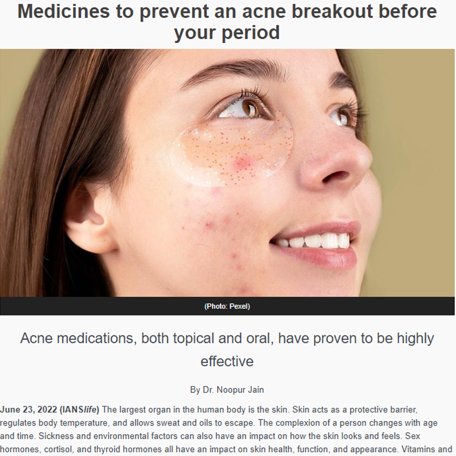 Medicines prevent acne breakout your period — Ianslife
