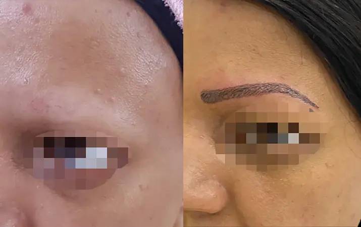 Eyebrow Microblading — before and after