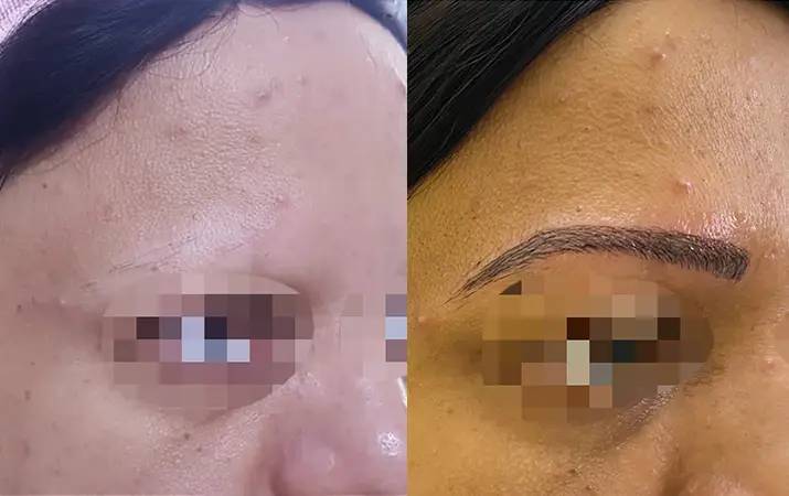 Eyebrow Microblading — before and after