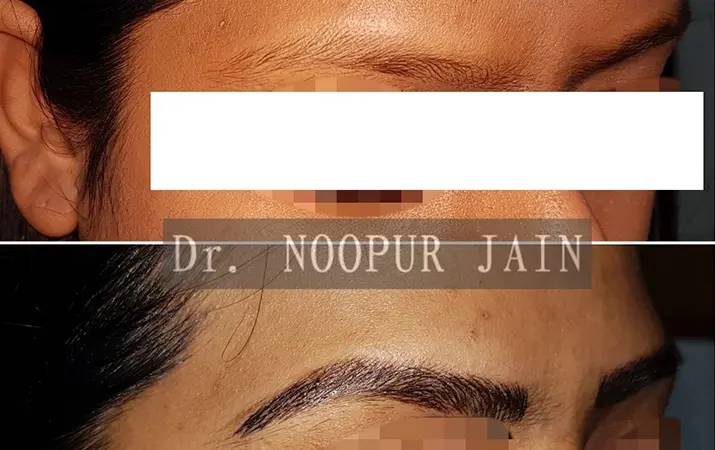 Eyebrow Microblading — before and after