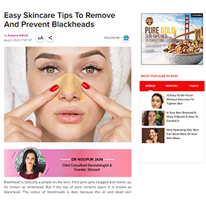 Easy skincare tips to remove and prevent blackheads — Femina