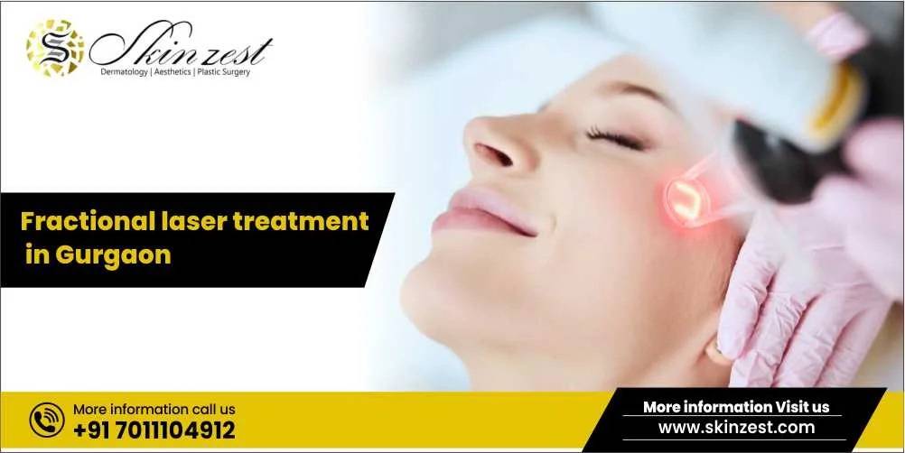 Fractional laser treatment in Gurgaon