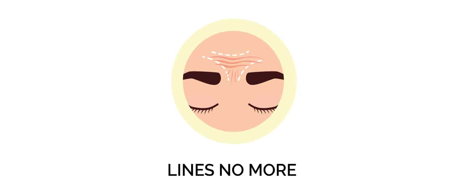 Lines No More