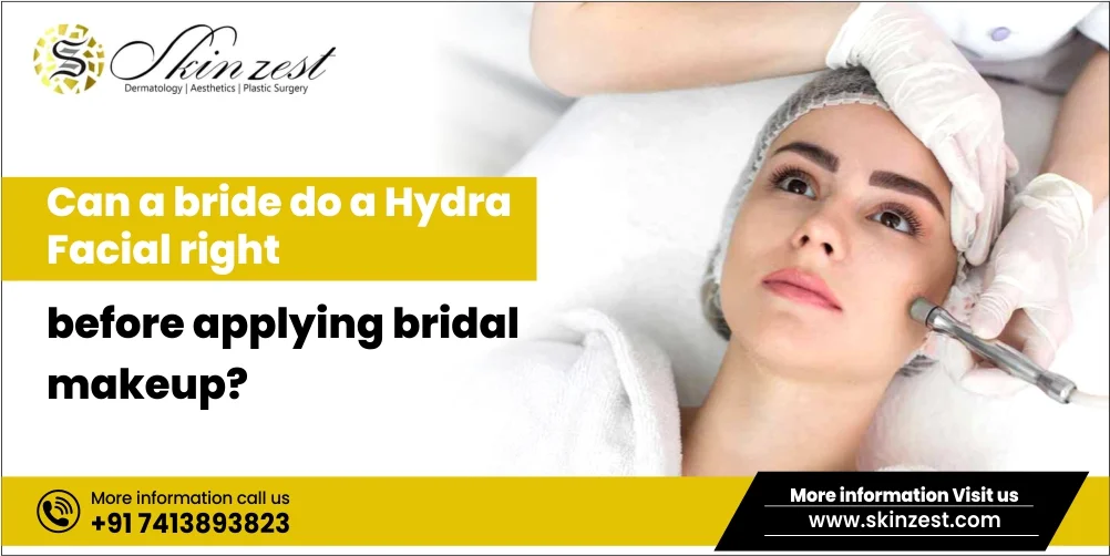 HydraFacial in Gurgaon