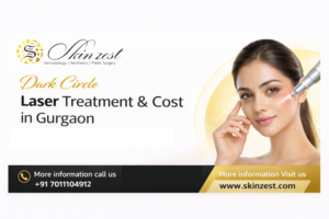 dark-circle-laser-treatment-in-gurgaon-showing-under-eye-pigmentation-reduction-with-safe-laser-therapy-for-brighter-smoother-and-even-toned-skin-results